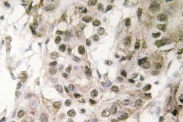 Polyclonal Rabbit anti-Human NPM1 / NPM / Nucleophosmin Antibody (Glu22, IHC, WB)