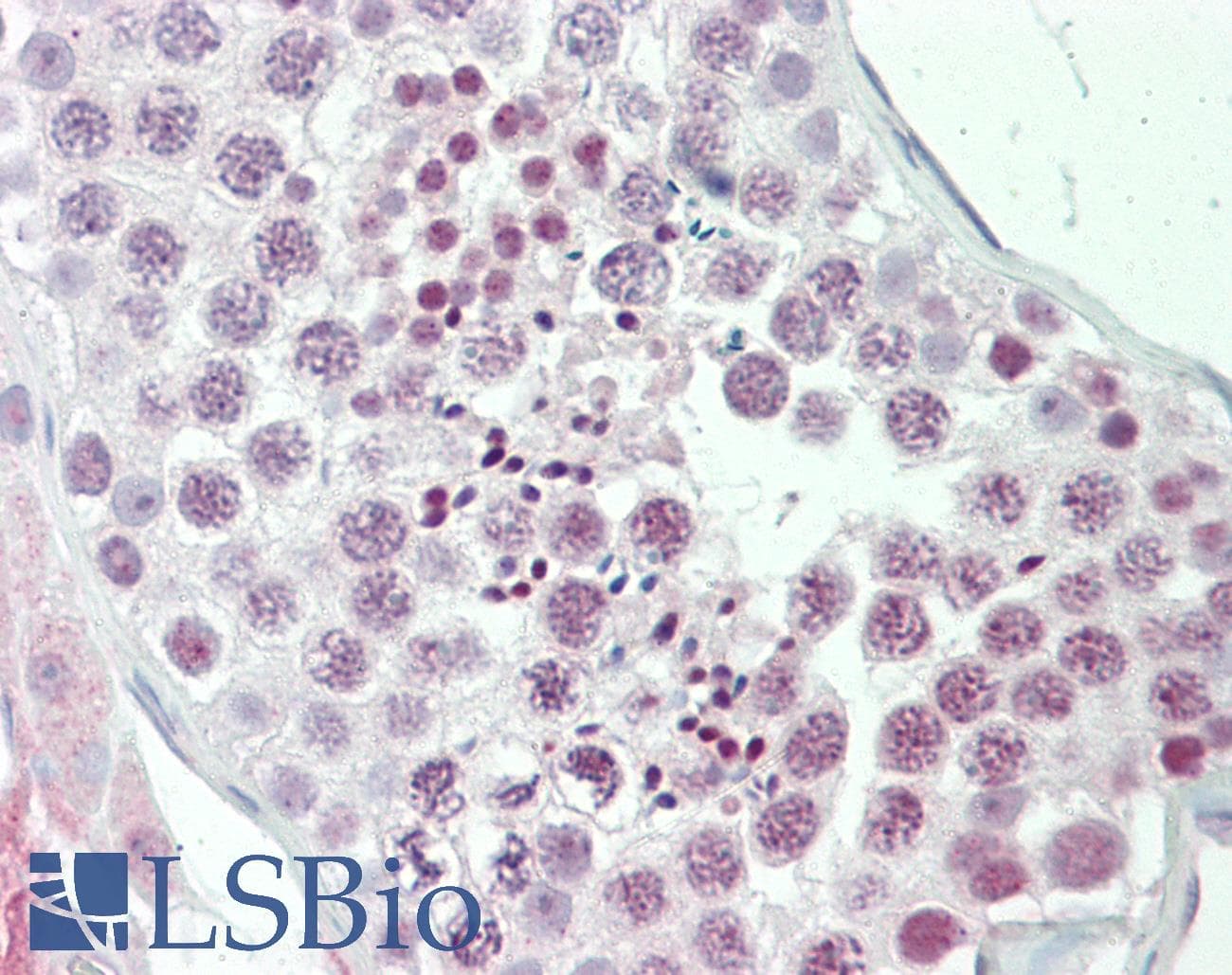 PRKAA1 / AMPK Alpha 1 Antibody (aa110-159)