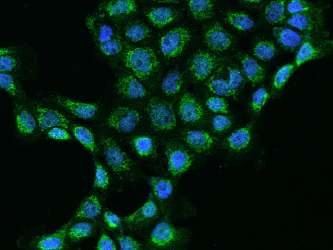 MRPL45 Antibody