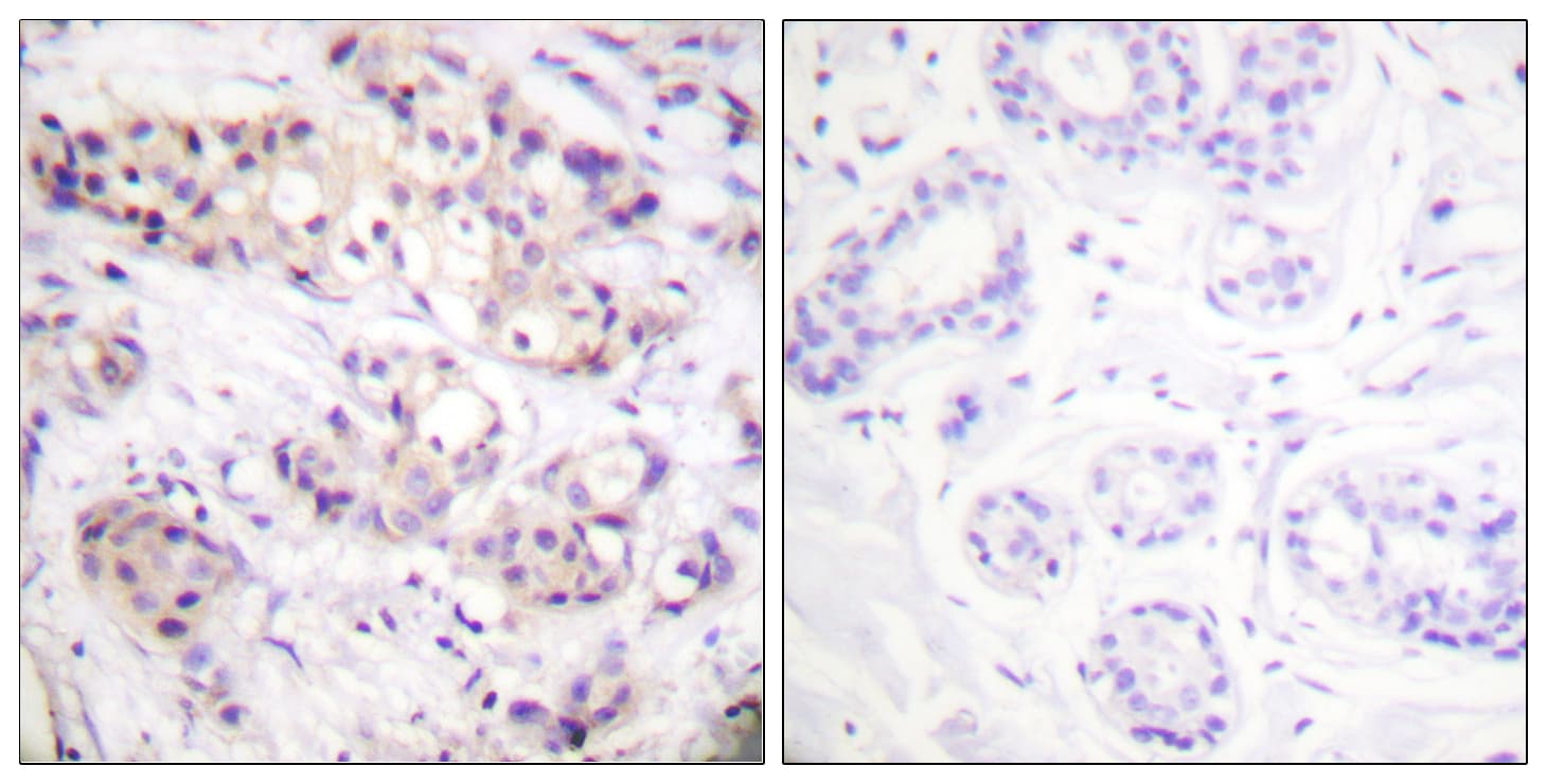PRKCA / PKC-Alpha Antibody (aa606-655)