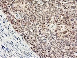 PSMB4 Antibody (clone OTI2C9)