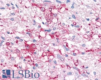 PathPlus™ Polyclonal Rabbit anti-Human P2RY6 / P2Y6 Antibody (Cytoplasmic Domain, IHC)