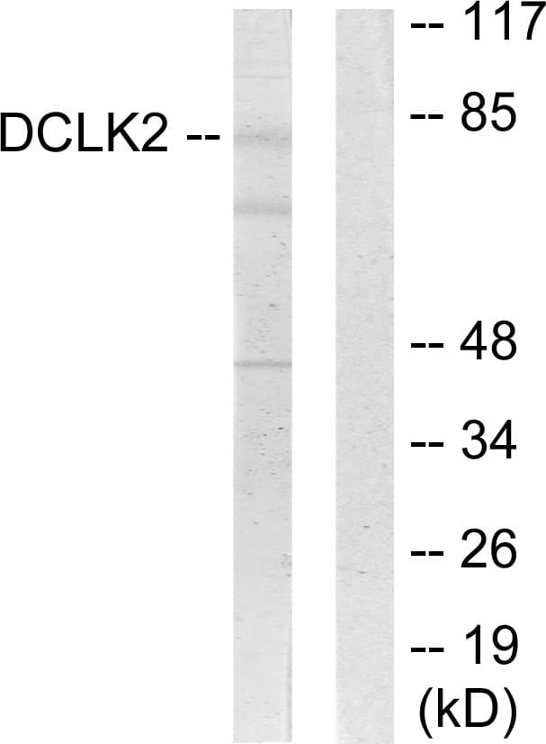 DCLK2 / DCAMKL2 Antibody (aa1-50)