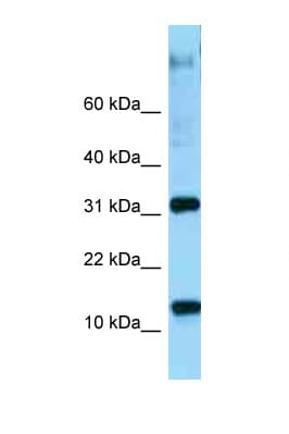 Polyclonal Rabbit anti-Human RPL22 / Ribosomal Protein L22 Antibody (aa73-122, WB)