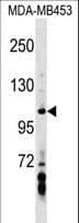 Polyclonal Rabbit anti-Human AXIN1 / Axin-1 Antibody (aa330-359, WB)