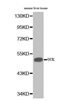 GCK / Glucokinase Antibody
