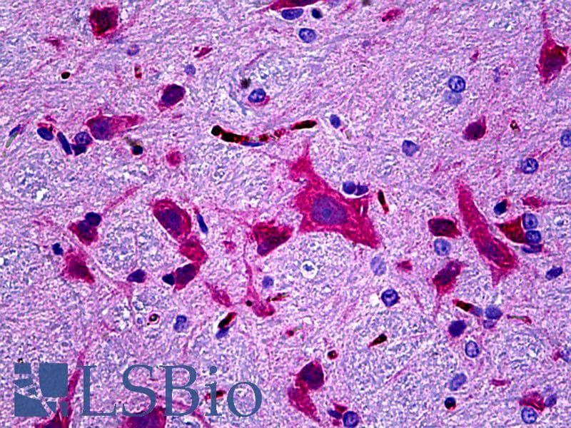 IHC-plus™ Monoclonal Mouse anti-Rat CAMK2B / CaMKII Beta Antibody (IHC, WB)