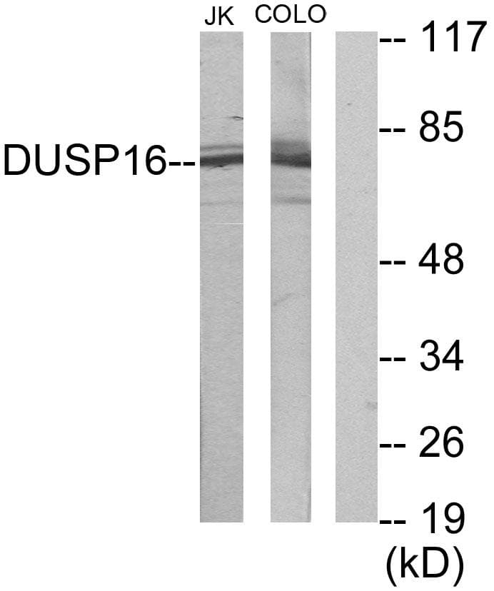 Polyclonal Rabbit anti-Human DUSP16 / MKP7 Antibody (IF, WB)