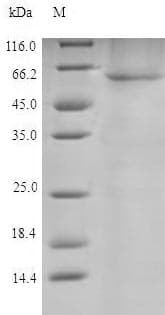 Hamster-Chinese PDI / P4HB Protein (Recombinant 6His, N-terminus)