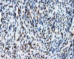 Monoclonal Mouse anti-Human MCL1 / MCL 1 Antibody (clone OTI4B7, IHC, IF, WB)