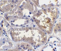Polyclonal Rabbit anti-Human CRADD / RAIDD Antibody (IHC, IF, WB)