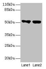 PathPlus™ KRT8 / CK8 / Cytokeratin 8 Antibody (aa2-483)