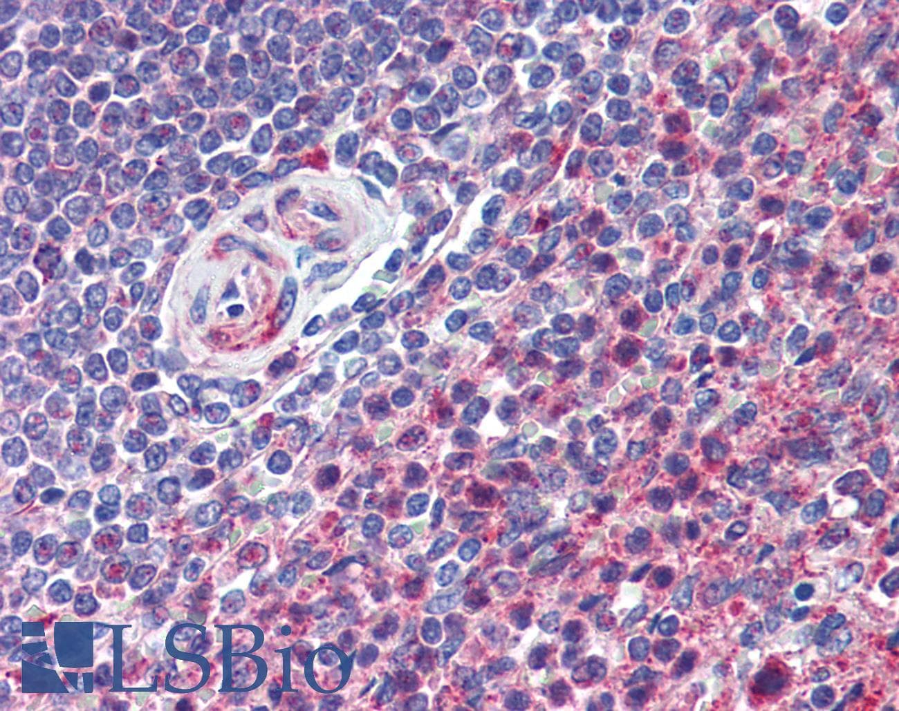IHC-plus™ Polyclonal Rabbit anti-Human ADGRE5 / CD97 Antibody (aa220-270, IHC, WB)