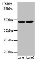 SSB / La Antibody