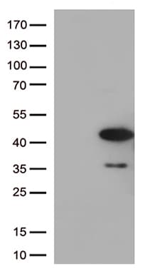 Monoclonal Mouse anti-Human PRKAB1 / AMPK Beta 1 Antibody (clone OTI3B11, aa2-270, WB)