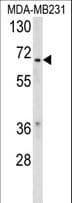 RXRB Antibody (aa256-284)