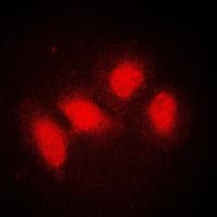 SMG7 Antibody (Internal)