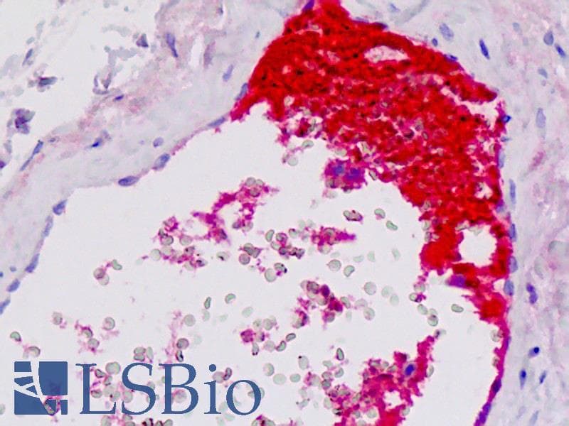 IHC-plus™ Complement C4c Antibody (clone 10-12)