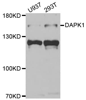 IHC-plus™ DAPK1 / DAP Kinase Antibody