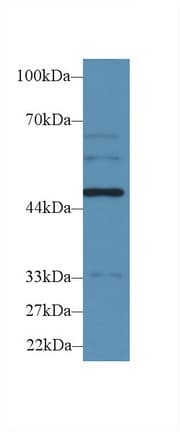 WARS Antibody (aa140-347)