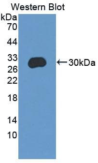 C/EBP Delta / CEBPD Antibody