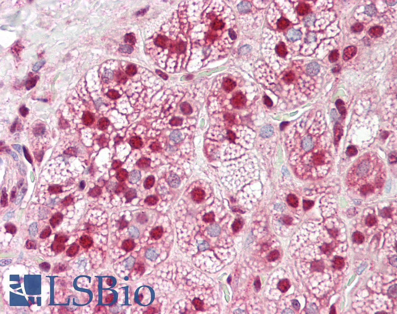 PathPlus™ Polyclonal Rabbit anti-Human HNRNPK / hnRNP K Antibody (aa380-430, IHC)