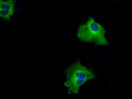 RIP1 / RALBP1 Antibody (clone OTI1C8)