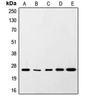 PathPlus™ SNAP25 Antibody (C-Terminus)