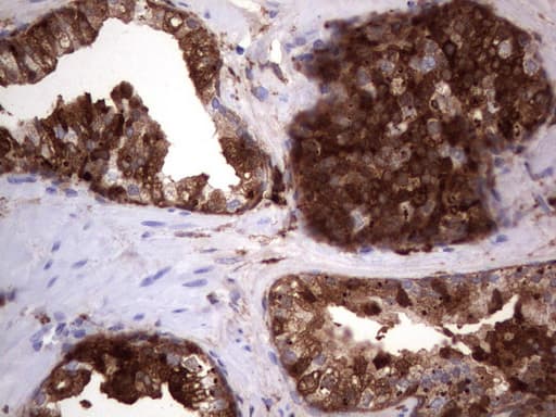 LGALS3 / Galectin 3 Antibody (clone UMAB157, Carrier-free)