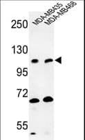 EXTL3 Antibody (aa43-72)