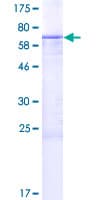 Human SPERT Protein (Recombinant GST)