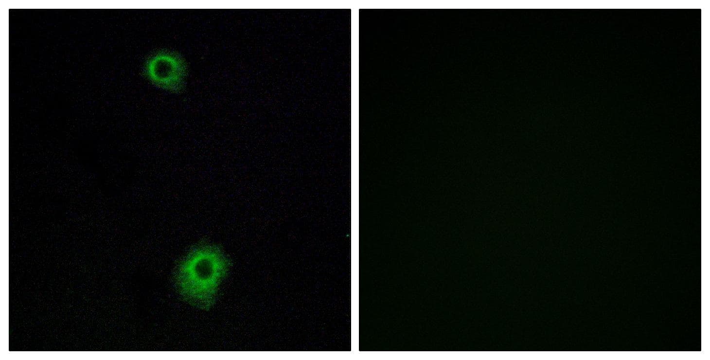 Polyclonal Rabbit anti-Human HTR1B / 5-HT1B Receptor Antibody (IF, WB)