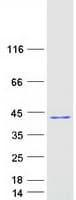 Human HYLS1 Protein (Recombinant Myc-DDK (Flag))