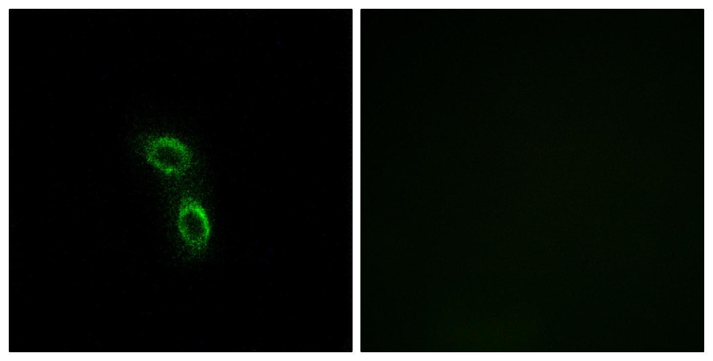 Polyclonal Rabbit anti-Human ARMC6 Antibody (IF, WB)