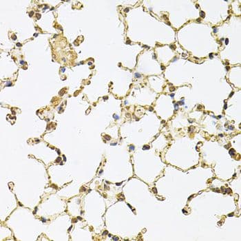 PSMA5 Antibody