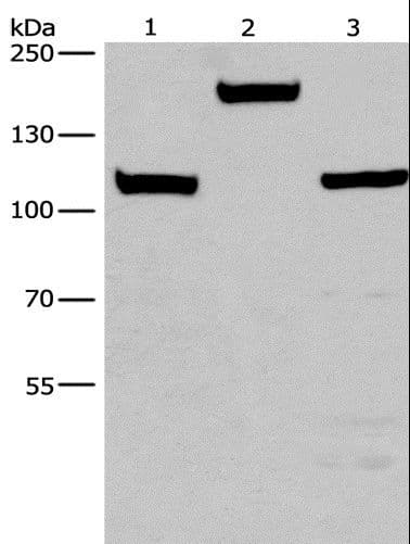TP53BP2 / ASPP2 Antibody