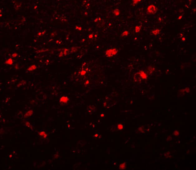 IHC-plus™ Polyclonal Rabbit anti-Human CCDC88A / GIV / Girdin Antibody (IHC, IF, WB)