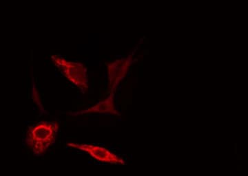 PRDX2 / Peroxiredoxin 2 Antibody
