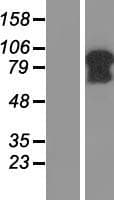 SIMC1 Protein (Over-Expression Lysate Myc-DDK (Flag))
