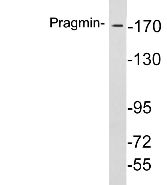 Polyclonal Rabbit anti-Human PRAGMIN / SGK223 Antibody (aa359-408, WB)