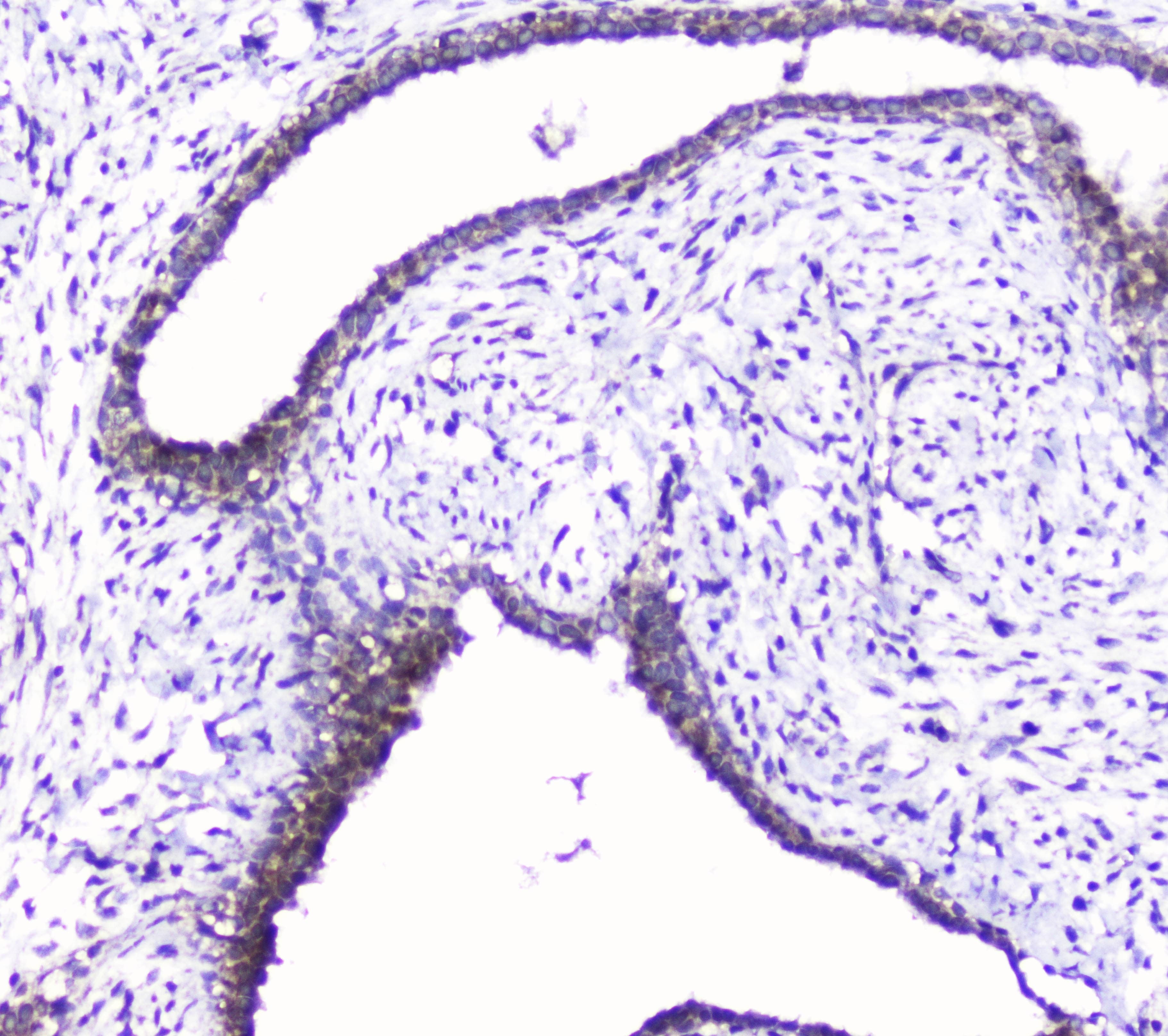Polyclonal Rabbit anti-Human CDK6 Antibody (WB)