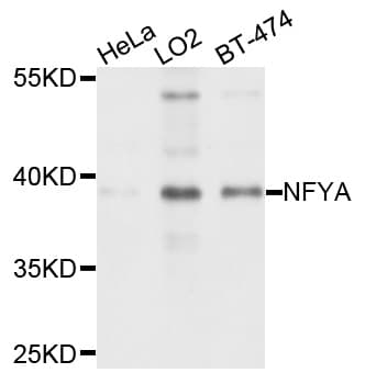 Polyclonal Rabbit anti-Human NFYA Antibody (IHC, WB)