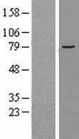 ALOX12B Protein (Over-Expression Lysate Myc-DDK (Flag))