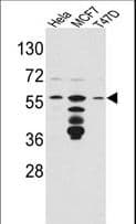 Polyclonal Rabbit anti-Human FKBP4 / FKBP52 Antibody (aa186-216, IHC, WB)