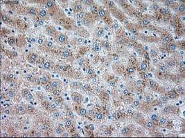 TRPM4 Antibody (clone OTI14C3)