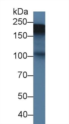 TNC / Tenascin C Antibody (aa513-621, PE)