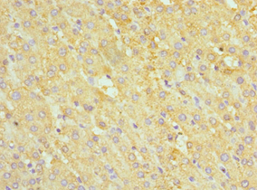 Polyclonal Rabbit anti-Human ABAT Antibody (aa29-300, IHC, WB)