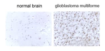 IHC-plus™ MAP1LC3B / LC3B Antibody (N-Terminus)