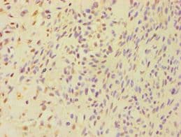 BSND / Barttin Antibody (aa54-320)