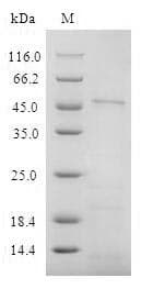 Human CD4 Protein (Recombinant 6His, N-terminus)
